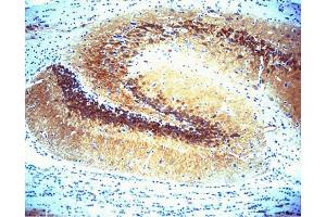 Immunohistochemical staining of CaM Kinase II on rat brain (center panel). (CAMK2A Antikörper  (AA 448-460))