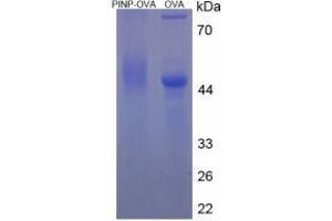 Image no. 3 for Procollagen I N-Terminal Propeptide (PINP) (N-Term) protein (Ovalbumin) (ABIN2127470)