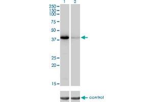 Western blot analysis of NEIL2 over-expressed 293 cell line, cotransfected with NEIL2 Validated Chimera RNAi (Lane 2) or non-transfected control (Lane 1). (NEIL2 Antikörper  (AA 1-332))
