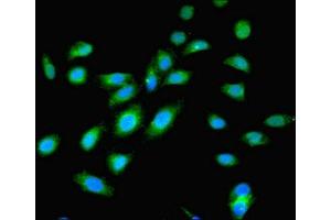 Immunofluorescent analysis of Hela cells using ABIN7174654 at dilution of 1:100 and Alexa Fluor 488-congugated AffiniPure Goat Anti-Rabbit IgG(H+L) (OGT Antikörper  (AA 606-1022))