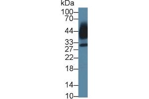 Detection of KLK13 in Human Saliva using Polyclonal Antibody to Kallikrein 13 (KLK13) (Kallikrein 13 Antikörper  (AA 25-261))