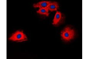 Immunofluorescent analysis of Claudin 6 staining in HuvEc cells. (Claudin 6 Antikörper  (Center))