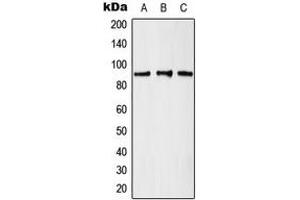 Western blot analysis of GCN5 expression in K562 (A), A431 (B), mouse brain (C) whole cell lysates.