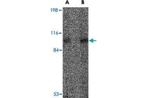 Western blot analysis of VPS53 in 293 cell lysate with VPS53 polyclonal antibody  at (A) 0. (VPS53 Antikörper  (Internal Region))