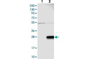 Western blot analysis of Lane 1: Negative control (vector only transfected HEK293T lysate), Lane 2: Over-expression Lysate (Co-expressed with a C-terminal myc-DDK tag (~3. (ZMAT5 Antikörper)