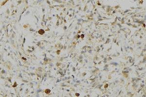 ABIN6276738 at 1/100 staining Human gastric tissue by IHC-P.