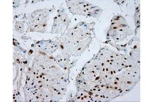 Image no. 2 for anti-Atrial Natriuretic Peptide Receptor 3 (NPR3) antibody (ABIN1499804) (NPR3 Antikörper)