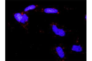 Proximity Ligation Analysis of protein-protein interactions between EPAS1 and SMAD3. (SMAD3 Antikörper  (AA 1-110))