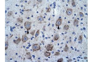 KCTD13 antibody was used for immunohistochemistry at a concentration of 4-8 ug/ml to stain Neural cells (arrows) in Human Brain. (KCTD13 Antikörper  (N-Term))