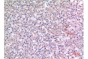 Immunohistochemistry (IHC) analysis of paraffin-embedded Human Liver, antibody was diluted at 1:100. (CMTM6 Antikörper  (C-Term))