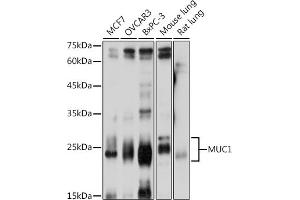 Western blot analysis of extracts of various cell lines, using MUC1 antibody (ABIN6131522, ABIN6144194, ABIN6144195 and ABIN6213810) at 1:1000 dilution. (MUC1 Antikörper  (AA 1182-1255))
