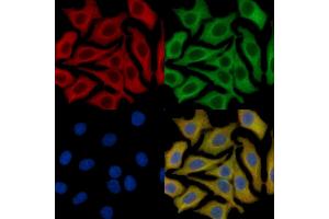 c-Kit Mouse Monoclonal Antibody staining HepG2 cells by IF/ICC.
