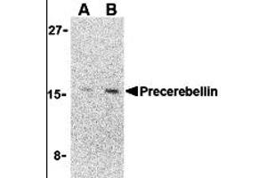 Western Blotting (WB) image for anti-Cerebellin 1 Precursor (CBLN1) (C-Term) antibody (ABIN1030599) (CBLN1 Antikörper  (C-Term))