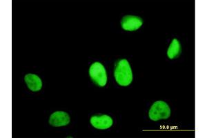 Immunofluorescence of monoclonal antibody to ZNF207 on HeLa cell. (ZNF207 Antikörper  (AA 1-110))