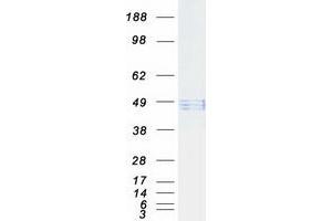Western Blotting (WB) image for Hyaluronidase-1 (HYAL1) (Transcript Variant 1) protein (Myc-DYKDDDDK Tag) (ABIN2723135)