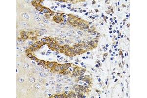 Immunohistochemistry of paraffin-embedded Human trachea using ESD Polyclonal Antibody at dilution of 1:100 (40x lens). (Esterase D Antikörper)