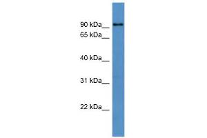 WB Suggested Anti-Dyrk1a Antibody Titration: 0. (DYRK1A Antikörper  (N-Term))