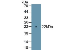 Detection of Recombinant PMP22, Rat using Polyclonal Antibody to Peripheral Myelin Protein 22 (PMP22) (PMP22 Antikörper)