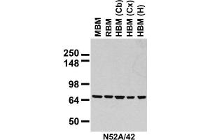 Immunoblot against crude membranes prepared from whole rat (RBM) and mouse (MBM) brain and human cerebral cortex [HBM(Cx)], cerebellum [HBM(Cb)], and hippocampus [HBM(H)] probed with N52A/42 TC supe. (HSPA9 Antikörper  (AA 551-766))