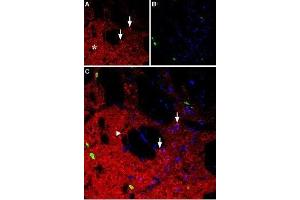 Expression of neuropeptide Y1 receptor in rat striatum - Immunohistochemical staining of rat striatum using Anti-NPY1R Antibody (ABIN7043371, ABIN7044668 and ABIN7044669). (NPY1R Antikörper  (3rd Intracellular Loop))