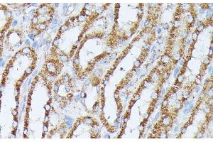 Immunohistochemistry (Paraffin-embedded Sections) (IHC (p)) image for anti-Protein Phosphatase 2, Catalytic Subunit, beta Isozyme (PPP2CB) antibody (ABIN7260829)