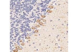 Immunohistochemistry analysis of paraffin-embedded mouse cerebellum using,Dgkz (ABIN7073722) at dilution of 1: 6000 (DGKZ Antikörper)