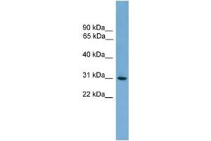 Western Blotting (WB) image for anti-Major Histocompatibility Complex, Class II, DQ alpha 2 (HLA-DQA2) (N-Term) antibody (ABIN2783759)