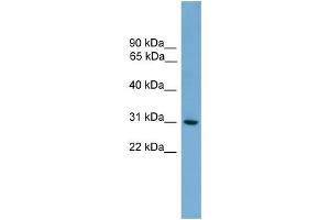 WB Suggested Anti-HLA-DQA2 Antibody Titration:  0. (HLA-DQA2 Antikörper  (N-Term))