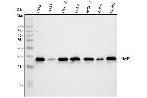 Western blot analysis of NM23A/NME1 using anti-NM23A/NME1 antibody (ABIN3043572).
