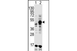 Western blot analysis of GDF9 (arrow) using rabbit polyclonal GDF9 Antibody (M45) (ABIN388822 and ABIN2839140). (GDF9 Antikörper  (N-Term))