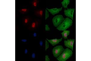 Phospho-PPP1CA (Thr320) Antibody staining A549 cells(heat shock treatment) by IF/ICC.