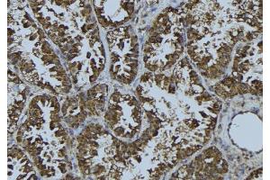 ABIN6275710 at 1/100 staining Mouse testis tissue by IHC-P. (TACC3 Antikörper  (C-Term))