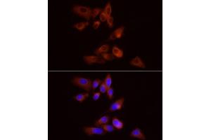 Immunofluorescence analysis of PC-3 cells using PYGB Rabbit pAb  at dilution of 1:100 (40x lens). (PYGB Antikörper  (AA 544-843))