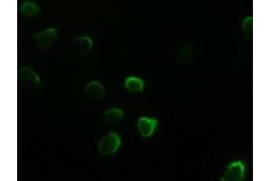 Anti-GATA4 mouse monoclonal antibody (ABIN2452678) immunofluorescent staining of HeLa cells transiently transfected by pCMV6-ENTRY GATA4 (RC210945) (GATA4 Antikörper  (AA 296-442))