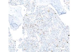 Immunohistochemistry (IHC) image for anti-CD22 Molecule (CD22) (AA 750-800) antibody (ABIN7795736)