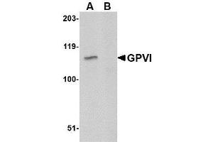 Western blot analysis of GPVI in A20 lysate with AP30378PU-N GPVI antibody at 1μg/ml in either the absence or (B) the presence of blocking peptide.