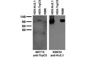 Adult rat brain membrane (RBM) and transfected cell immunoblot: extracts of RBM and HEK-293 cells transiently transfected with TrpC5 and Kv2.
