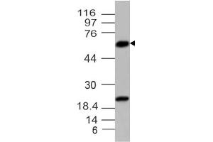 Image no. 1 for anti-Parathyroid Hormone (PTH) (AA 1-236) antibody (ABIN5027427) (PTH Antikörper  (AA 1-236))
