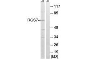 Western blot analysis of extracts from Jurkat cells, using RGS7 Antibody. (RGS7 Antikörper  (AA 155-204))