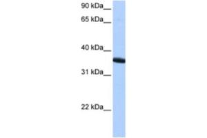 Western Blotting (WB) image for anti-Zinc Finger Protein 192 Pseudogene 1 (ZNF192P1) antibody (ABIN2463407) (ZNF192P1 Antikörper)
