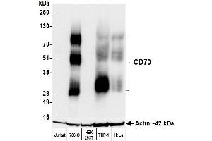 Western Blotting (WB) image for anti-CD70 Molecule (CD70) (AA 50-193) antibody (ABIN7795663)