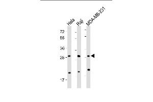 All lanes : Anti-RAB12 Antibody (N-term) at 1:2000 dilution Lane 1: Hela whole cell lysate Lane 2: Raji whole cell lysate Lane 3: MDA-MB-231 whole cell lysate Lysates/proteins at 20 μg per lane. (RAB12 Antikörper  (N-Term))