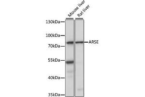 Western blot analysis of extracts of various cell lines, using ARSE antibody (ABIN7265688) at 1:1000 dilution. (Arylsulfatase E Antikörper  (AA 520-589))