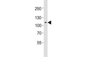 Western blot testing of Mertk antibody at 1:1000 dilution + mouse spleen lysate; Predicted molecular weight: 110~205 kDa depending on glycosylation level