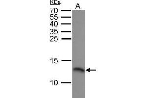 WB Image RPA14 antibody detects RPA14 protein by Western blot analysis.