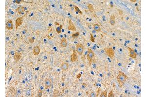 ABIN6265688 and ABIN6278646 at 1/100 staining Mouse brain tissue by IHC-P. (Tryptophan Hydroxylase 2 Antikörper  (N-Term))