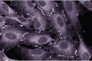Immunofluorescent staining of EAHY human endothelial cells. (TJP1 Antikörper  (AA 1048-1247))