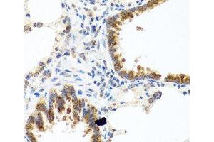 Immunohistochemistry of paraffin-embedded Rat lung using C8orf4 Polyclonal Antibody at dilution of 1:100 (40x lens). (C8orf4 Antikörper)