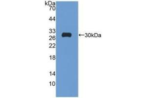 Detection of Recombinant GR, Rat using Polyclonal Antibody to Glutathione Reductase (GR) (Glutathione Reductase Antikörper  (AA 7-246))