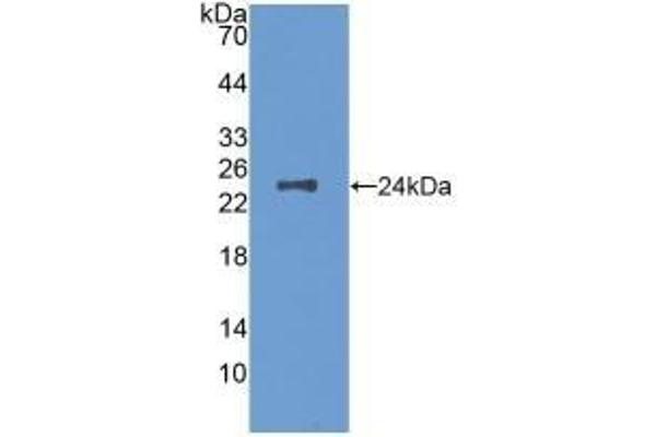 M-CSF/CSF1 antibody  (AA 33-204)